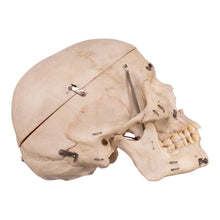 Load image into Gallery viewer, Real Human Dissected Skull with Carrying Case
