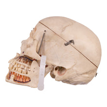 Load image into Gallery viewer, Real Human Dissected Skull with Carrying Case
