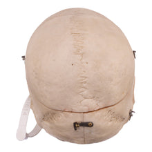 Load image into Gallery viewer, Real Human Dissected Skull with Carrying Case
