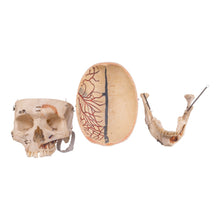 Load image into Gallery viewer, Real Human Dissected Skull with Carrying Case
