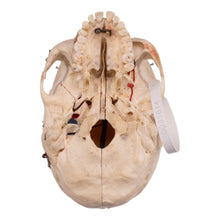 Load image into Gallery viewer, Real Human Dissected Skull with Carrying Case
