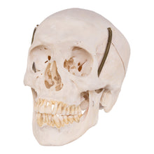 Load image into Gallery viewer, Real Human Skull with Carrying Case
