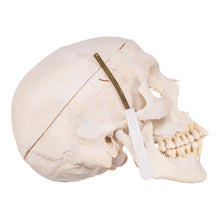 Load image into Gallery viewer, Real Human Skull with Carrying Case
