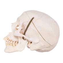 Load image into Gallery viewer, Real Human Skull with Carrying Case
