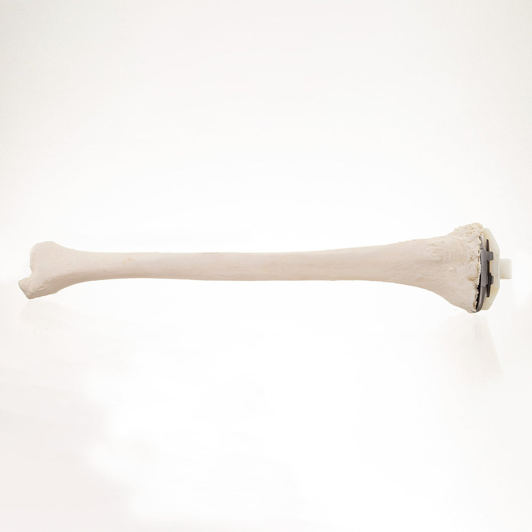 Real Research Quality Human Tibia